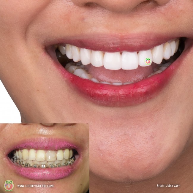get-your-smile-here--1